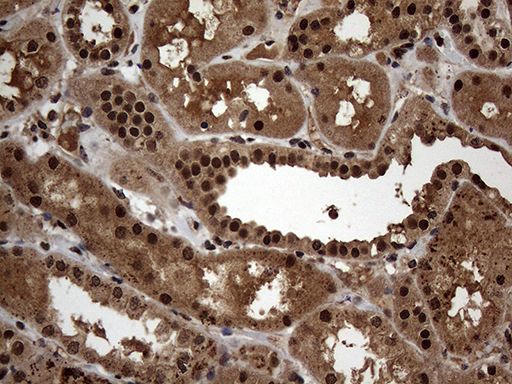 SSU72 Antibody - Immunohistochemical staining of paraffin-embedded Human Kidney tissue within the normal limits using anti-SSU72 mouse monoclonal antibody. (Heat-induced epitope retrieval by 1mM EDTA in 10mM Tris buffer. (pH8.5) at 120°C for 3 min. (1:500)