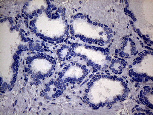 SSU72 Antibody - Immunohistochemical staining of paraffin-embedded Human prostate tissue within the normal limits using anti-SSU72 mouse monoclonal antibody. This figure shows negative staining. (Heat-induced epitope retrieval by 1mM EDTA in 10mM Tris buffer. (pH8.5) at 120°C for 3 min. (1:500)