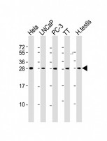 SSX1 Antibody - All lanes: Anti-SSX1 Antibody (Center) at 1:2000 dilution. Lane 1: HeLa whole cell lysate. Lane 2: LNCaP whole cell lysate. Lane 3: PC-3 whole cell lysate. Lane 4: TT whole cell lysate. Lane 5: human testis lysate Lysates/proteins at 20 ug per lane. Secondary Goat Anti-Rabbit IgG, (H+L), Peroxidase conjugated at 1:10000 dilution. Predicted band size: 22 kDa. Blocking/Dilution buffer: 5% NFDM/TBST.