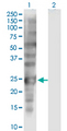 SSX1 Antibody - Western Blot analysis of SSX1 expression in transfected 293T cell line by SSX1 monoclonal antibody (M01), clone 5B2.Lane 1: SSX1 transfected lysate (Predicted MW: 21.9 KDa).Lane 2: Non-transfected lysate.