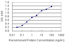SSX1 Antibody - Detection limit for recombinant GST tagged SSX1 is 0.03 ng/ml as a capture antibody.