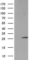 SSX1 Antibody - HEK293T cells were transfected with the pCMV6-ENTRY control (Left lane) or pCMV6-ENTRY SSX1 (Right lane) cDNA for 48 hrs and lysed. Equivalent amounts of cell lysates (5 ug per lane) were separated by SDS-PAGE and immunoblotted with anti-SSX1.