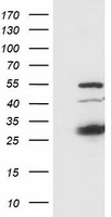 SSX1 Antibody - HEK293T cells were transfected with the pCMV6-ENTRY control (Left lane) or pCMV6-ENTRY SSX1 (Right lane) cDNA for 48 hrs and lysed. Equivalent amounts of cell lysates (5 ug per lane) were separated by SDS-PAGE and immunoblotted with anti-SSX1.