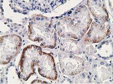 SSX1 Antibody - IHC of paraffin-embedded Human Kidney tissue using anti-SSX1 mouse monoclonal antibody.