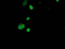 SSX1 Antibody - Anti-SSX1 mouse monoclonal antibody immunofluorescent staining of COS7 cells transiently transfected by pCMV6-ENTRY SSX1.