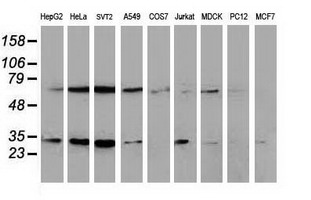 SSX1 Antibody - Western blot of extracts (35 ug) from 9 different cell lines by using anti-SSX1 monoclonal antibody.