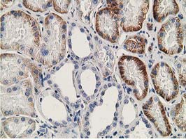 SSX1 Antibody - IHC of paraffin-embedded Human Kidney tissue using anti-SSX1 mouse monoclonal antibody. (Heat-induced epitope retrieval by 10mM citric buffer, pH6.0, 100C for 10min).