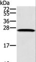 SSX1 Antibody - Western blot analysis of K562 cell, using SSX1 Polyclonal Antibody at dilution of 1:400.