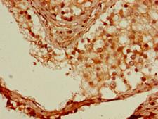 SSX1 Antibody - Immunohistochemistry of paraffin-embedded human testis tissue using SSX1 Antibody at dilution of 1:100