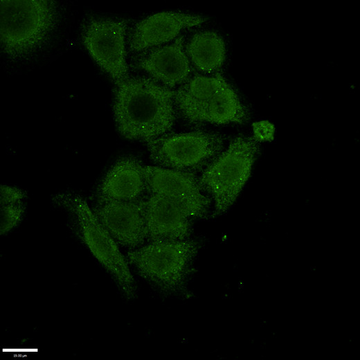 SSX1 Antibody - Immunofluorescent analysis of PC3 cells using SSX1 Antibody at a dilution of 1:100 and Alexa Fluor 488-congugated AffiniPure Goat Anti-Rabbit IgG(H+L)
