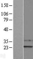 SSX1 Protein - Western validation with an anti-DDK antibody * L: Control HEK293 lysate R: Over-expression lysate