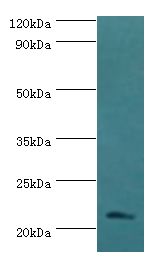 SSX2 Antibody - Western blot. All lanes: Protein SSX2 antibody at 2 ug/ml+MDA-MB-231 whole cell lysate. Secondary antibody: Goat polyclonal to rabbit at 1:10000 dilution. Predicted band size: 22 kDa. Observed band size: 22 kDa.