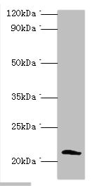 SSX2 Antibody - Western blot All lanes: Protein SSX2 antibody at 2µg/ml + MDA-MB-231 whole cell lysate Secondary Goat polyclonal to rabbit IgG at 1/10000 dilution Predicted band size: 22, 26 kDa Observed band size: 22 kDa