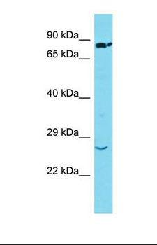SSX2 Antibody - Western blot of Human Lung Tumor. SSX2 antibody dilution 1.0 ug/ml.  This image was taken for the unconjugated form of this product. Other forms have not been tested.