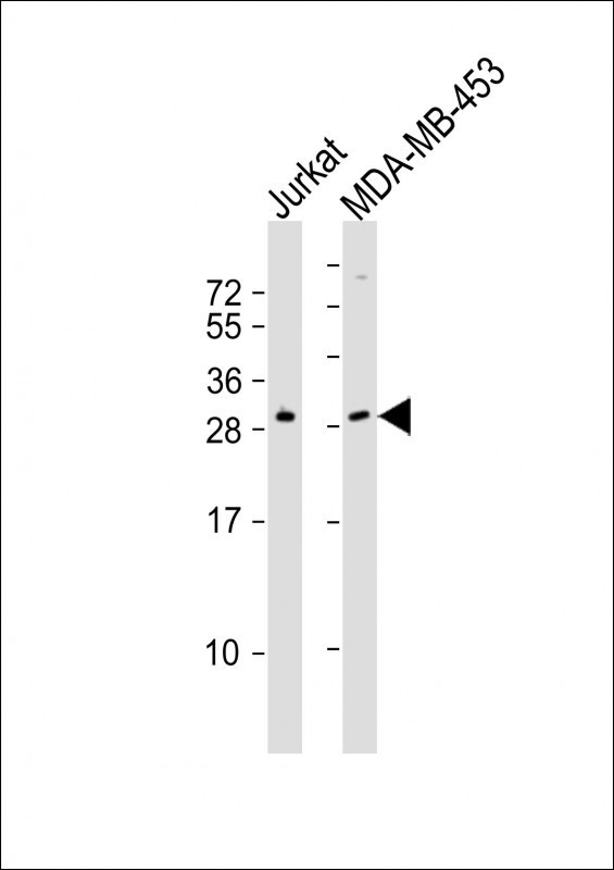 SSX2 Antibody - All lanes : Anti-SSX2 Antibody at 1:2000 dilution Lane 1: Jurkat whole cell lysates Lane 2: MDA-MB-453 whole cell lysates Lysates/proteins at 20 ug per lane. Secondary Goat Anti-Rabbit IgG, (H+L), Peroxidase conjugated at 1/10000 dilution Predicted band size : 22 kDa Blocking/Dilution buffer: 5% NFDM/TBST.