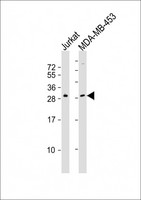 SSX2 Antibody - All lanes : Anti-SSX2 Antibody at 1:2000 dilution Lane 1: Jurkat whole cell lysates Lane 2: MDA-MB-453 whole cell lysates Lysates/proteins at 20 ug per lane. Secondary Goat Anti-Rabbit IgG, (H+L), Peroxidase conjugated at 1/10000 dilution Predicted band size : 22 kDa Blocking/Dilution buffer: 5% NFDM/TBST.