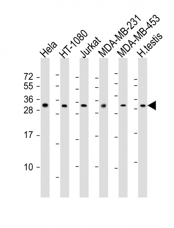 SSX2 Antibody - All lanes : Anti-SSX2 Antibody at 1:2000 dilution Lane 1: HeLa whole cell lysates Lane 2: HT-1080 whole cell lysates Lane 3: Jurkat whole cell lysates Lane 4: MDA-MB-231 whole cell lysates Lane 5: MDA-MB-453 whole cell lysates Lane 6: human testis lysates Lysates/proteins at 20 ug per lane. Secondary Goat Anti-Rabbit IgG, (H+L), Peroxidase conjugated at 1/10000 dilution Predicted band size : 22 kDa Blocking/Dilution buffer: 5% NFDM/TBST.