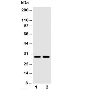 SSX2 Antibody - Western blot testing of SSX2 antibody and Lane 1: MCF-7; 2: HeLa cell lysate