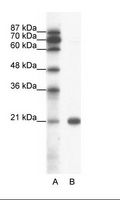SSX2 Antibody - A: Marker, B: Jurkat Cell Lysate.  This image was taken for the unconjugated form of this product. Other forms have not been tested.