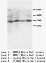 SSX2 Antibody -  This image was taken for the unconjugated form of this product. Other forms have not been tested.