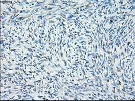 SSX2 Antibody - IHC of paraffin-embedded Ovary tissue using anti-SSX2 mouse monoclonal antibody. (Dilution 1:50).