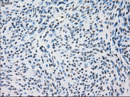 SSX2 Antibody - IHC of paraffin-embedded endometrium tissue using anti-SSX2 mouse monoclonal antibody. (Dilution 1:50).