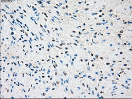 SSX2 Antibody - IHC of paraffin-embedded prostate tissue using anti-SSX2 mouse monoclonal antibody. (Dilution 1:50).