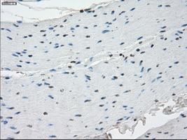 SSX2 Antibody - IHC of paraffin-embedded colon tissue using anti-SSX2 mouse monoclonal antibody. (Dilution 1:50).