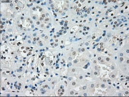 SSX2 Antibody - IHC of paraffin-embedded Kidney tissue using anti-SSX2 mouse monoclonal antibody. (Dilution 1:50).