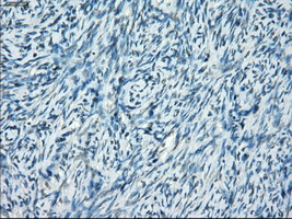 SSX2 Antibody - IHC of paraffin-embedded Ovary tissue using anti-SSX2 mouse monoclonal antibody. (Dilution 1:50).
