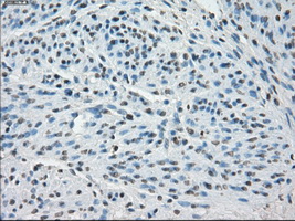 SSX2 Antibody - IHC of paraffin-embedded endometrium tissue using anti-SSX2 mouse monoclonal antibody. (Dilution 1:50).