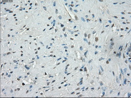 SSX2 Antibody - IHC of paraffin-embedded prostate tissue using anti-SSX2 mouse monoclonal antibody. (Dilution 1:50).