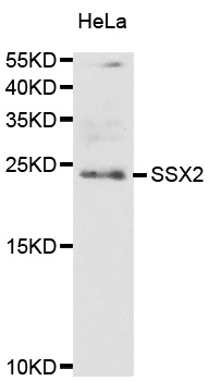 SSX2 Antibody - Western blot analysis of extract of HeLa cellss.