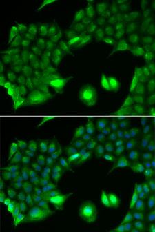 SSX2 Antibody - Immunofluorescence analysis of HeLa cells.