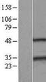 SSX2 Protein - Western validation with an anti-DDK antibody * L: Control HEK293 lysate R: Over-expression lysate