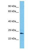 SSX2B Antibody - SSX2B antibody Western Blot of Jurkat. Antibody dilution: 1 ug/ml.  This image was taken for the unconjugated form of this product. Other forms have not been tested.