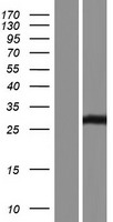 SSX2B Protein - Western validation with an anti-DDK antibody * L: Control HEK293 lysate R: Over-expression lysate
