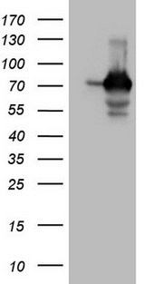 SSX2IP Antibody - HEK293T cells were transfected with the pCMV6-ENTRY control. (Left lane) or pCMV6-ENTRY SSX2IP. (Right lane) cDNA for 48 hrs and lysed. Equivalent amounts of cell lysates. (5 ug per lane) were separated by SDS-PAGE and immunoblotted with anti-SSX2IP. (1:2000)