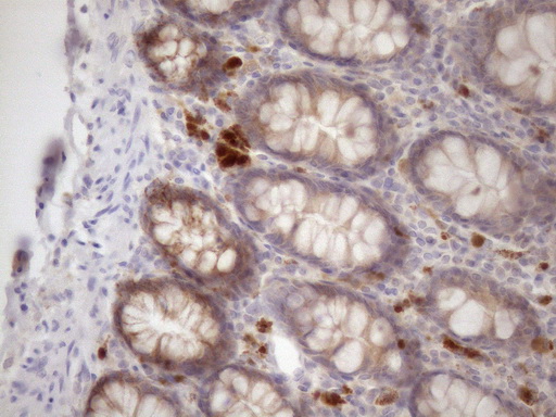 SSX2IP Antibody - Immunohistochemical staining of paraffin-embedded Human colon tissue within the normal limits using anti-SSX2IP mouse monoclonal antibody. (Heat-induced epitope retrieval by 1mM EDTA in 10mM Tris buffer. (pH8.5) at 120 oC for 3 min. (1:150)
