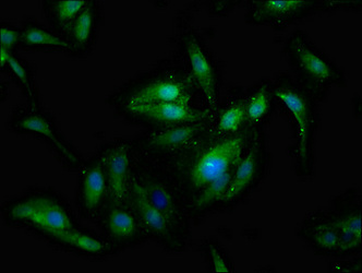 SSX2IP Antibody - Immunofluorescence staining of Hela cells at a dilution of 1:133, counter-stained with DAPI. The cells were fixed in 4% formaldehyde, permeabilized using 0.2% Triton X-100 and blocked in 10% normal Goat Serum. The cells were then incubated with the antibody overnight at 4°C.The secondary antibody was Alexa Fluor 488-congugated AffiniPure Goat Anti-Rabbit IgG (H+L) .