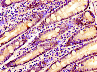 SSX2IP Antibody - Immunohistochemistry image at a dilution of 1:100 and staining in paraffin-embedded human small intestine tissue performed on a Leica BondTM system. After dewaxing and hydration, antigen retrieval was mediated by high pressure in a citrate buffer (pH 6.0) . Section was blocked with 10% normal goat serum 30min at RT. Then primary antibody (1% BSA) was incubated at 4 °C overnight. The primary is detected by a biotinylated secondary antibody and visualized using an HRP conjugated SP system.