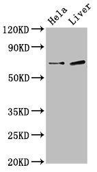 SSX2IP Antibody - Positive Western Blot detected in Hela whole cell lysate, Rat liver tissue. All lanes: SSX2IP antibody at 3 µg/ml Secondary Goat polyclonal to rabbit IgG at 1/50000 dilution. Predicted band size: 72, 66, 69 KDa. Observed band size: 72 KDa