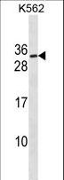 SSX3 Antibody - SSX3 Antibody western blot of K562 cell line lysates (35 ug/lane). The SSX3 Antibody detected the SSX3 protein (arrow).