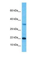 SSX3 Antibody - Western blot of SSX3 Antibody with human Fetal Kidney lysate.  This image was taken for the unconjugated form of this product. Other forms have not been tested.