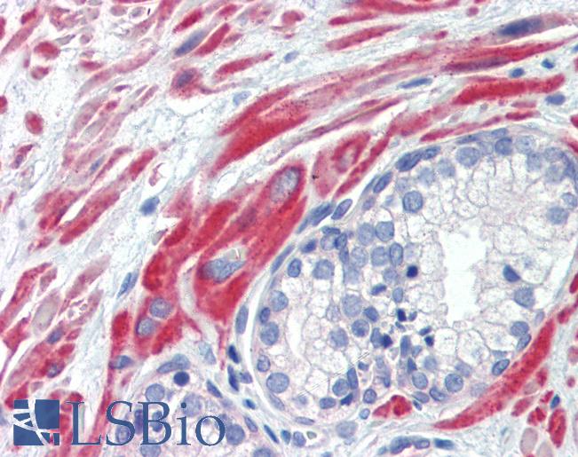 SSX4 Antibody - Anti-SSX4 antibody IHC of human prostate. Immunohistochemistry of formalin-fixed, paraffin-embedded tissue after heat-induced antigen retrieval. Antibody concentration 5 ug/ml.  This image was taken for the unconjugated form of this product. Other forms have not been tested.