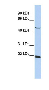 SSX4 Antibody - SSX4 antibody Western blot of HepG2 cell lysate. This image was taken for the unconjugated form of this product. Other forms have not been tested.
