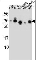 SSX4 Antibody - SSX4 Antibody western blot of CEM,K562,NCI-H292,MDA-MB453,A549 cell line lysates (35 ug/lane). The SSX4 antibody detected the SSX4 protein (arrow).