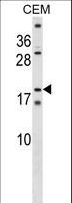 SSX4 Antibody - SSX4 Antibody western blot of CEM cell line lysates (35 ug/lane). The SSX4 antibody detected the SSX4 protein (arrow).