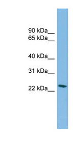 SSX4 Antibody - SSX4B antibody Western blot of Fetal Kidney lysate. This image was taken for the unconjugated form of this product. Other forms have not been tested.