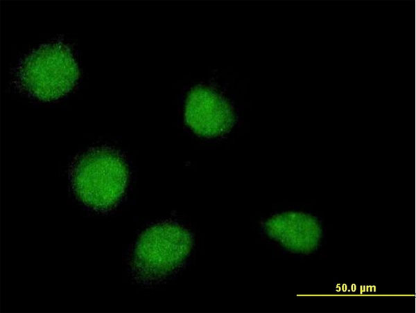 SSX4 Antibody - Immunofluorescence of monoclonal antibody to SSX4 on HeLa cell . [antibody concentration 10 ug/ml]